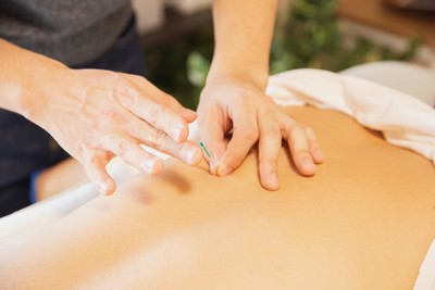 Acupuncture Alpha Massage Therapy and Wellness Coquitlam